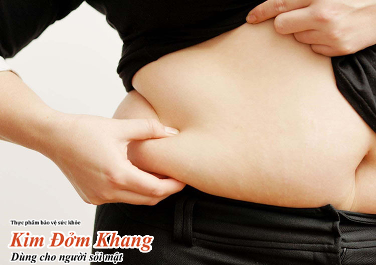 Thừa cân, béo phì là một trong những yếu tố nguy cơ hình thành sỏi túi mật