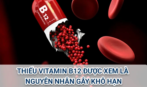 Thieu-vitamin-B12-duoc-xem-la-nguyen-nhan-gay-kho-han-giam-ham-muon-o-phai-nu