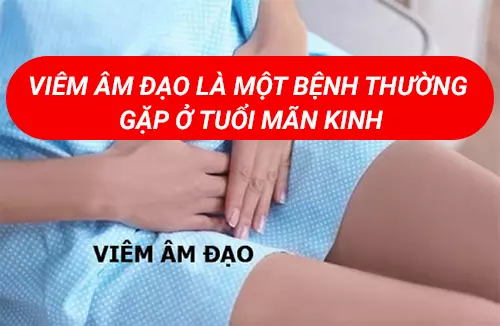 Viem-am-dao-la-mot-trong-nhung-benh-thuong-gap-o-tuoi-man-kinh