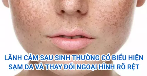 Phu-nu-mac-lanh-cam-sau-sinh-thuong-co-bieu-hien-sam-da-va-thay-doi-ngoai-hinh-ro-ret