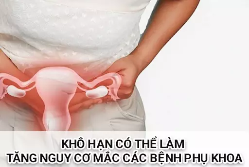 Kho-han-keo-dai-co-the-lam-tang-nguy-co-mac-cac-benh-phu-khoa-o-nu-gioi