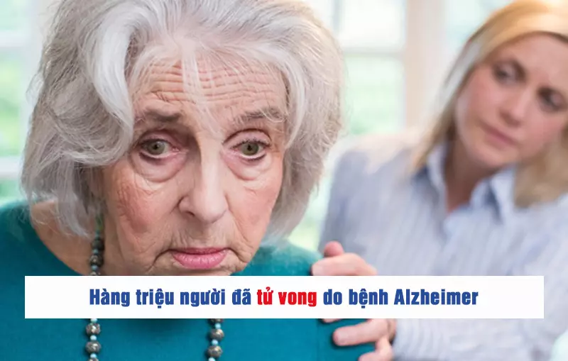 Benh-Alzheimer-gay-tu-vong-do-nhieu-nguyen-nhan