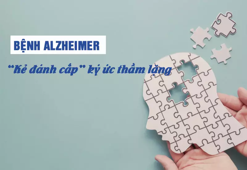 Bệnh Alzheimer - Làm thế nào để phòng ngừa sa sút trí tuệ?