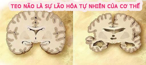 Teo não là sự lão hóa tự nhiên của cơ thể