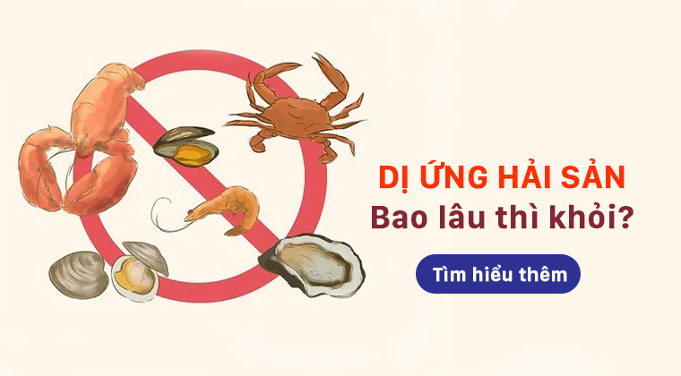 Thông Tin Chi Tiết về Dị Ứng Hải Sản