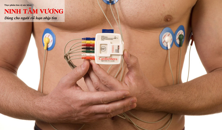 đo điện tim để biết nhịp tim nhanh hay chậm