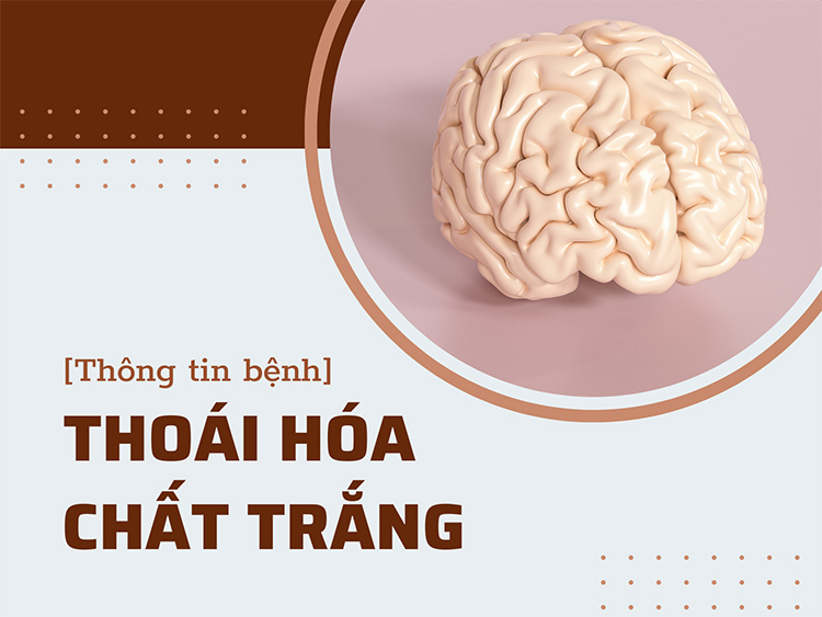 Tìm hiểu toàn bộ thông tin về bệnh thoái hóa chất trắng não