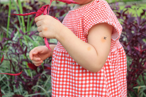 Trẻ bị muỗi đốt sưng to, nhiều nốt đỏ, bôi gì để nhanh khỏi? Giải pháp hiệu quả từ sản phẩm thảo dược