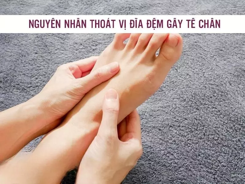 nguyen-nhan-thoat-vi-dia-dem-gay-te-chan.webp