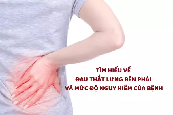 Tìm hiểu về đau thắt lưng bên phải và mức độ nguy hiểm của bệnh