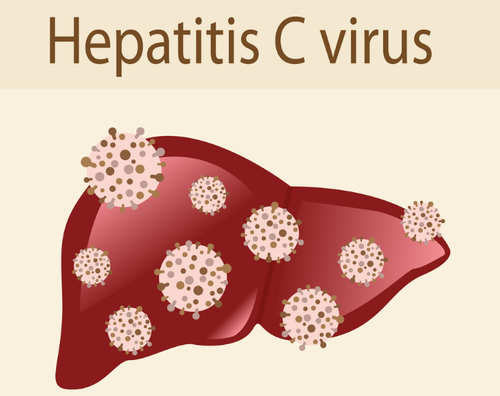 Viem-gan-C-do-virus-Hepatitis-C-gay-ra