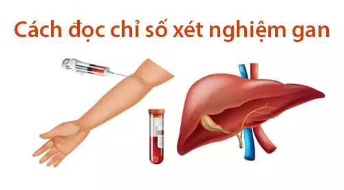 Hướng dẫn cách đọc chỉ số xét nghiệm gan chính xác nhất!