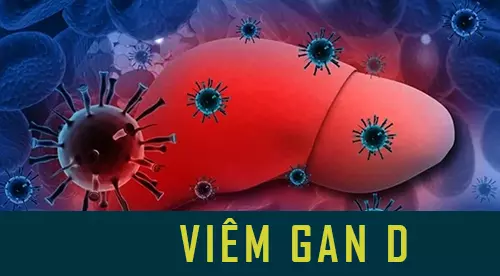 Tổng quan về viêm gan D và phác đồ điều trị bệnh mới nhất