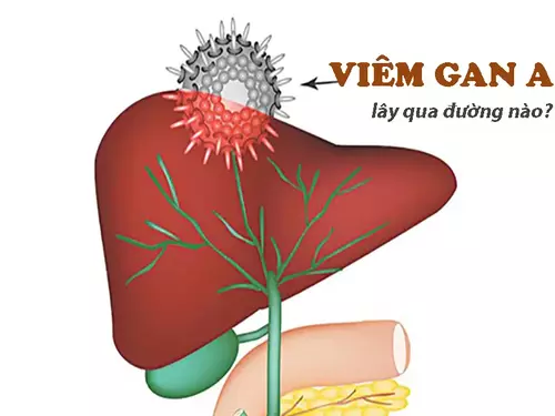 Viêm gan A lây qua đường nào? Bệnh có gây nguy hiểm không?