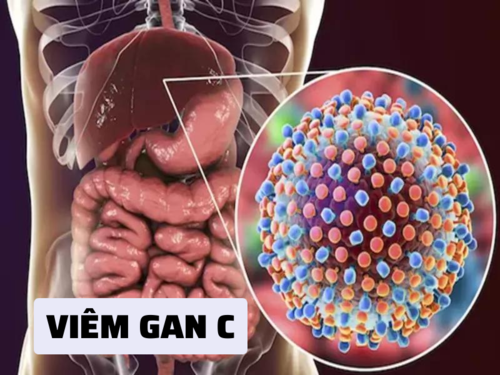 Tổng quan về viêm gan C và phác đồ điều trị bệnh mới nhất   