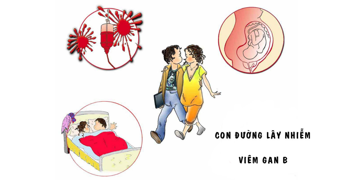 viem-gan-b-co-the-lay-truyen-qua-nhieu-con-duong-khac-nhau.png