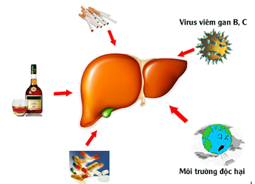 viem-gan-co-the-do-nhiem-doc-tu-nhieu-nguon.png