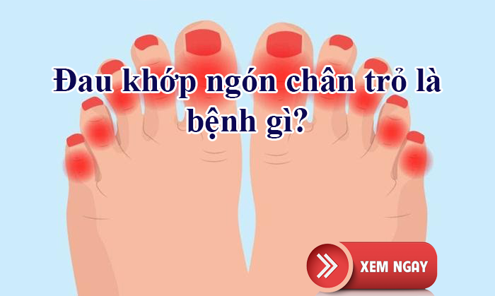 Đau khớp ngón chân trỏ là bệnh gì? Làm thế nào để ngón chân đỡ đau?