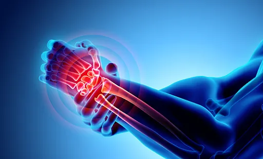 Viêm khớp cổ tay và bài tập giúp giảm đau khớp cổ tay hiệu quả