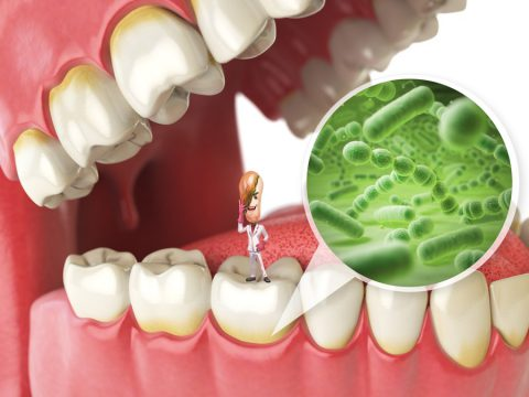 Vi khuẩn, virus là nguyên nhân gây nên các bệnh nhiễm trùng ở khoang miệng