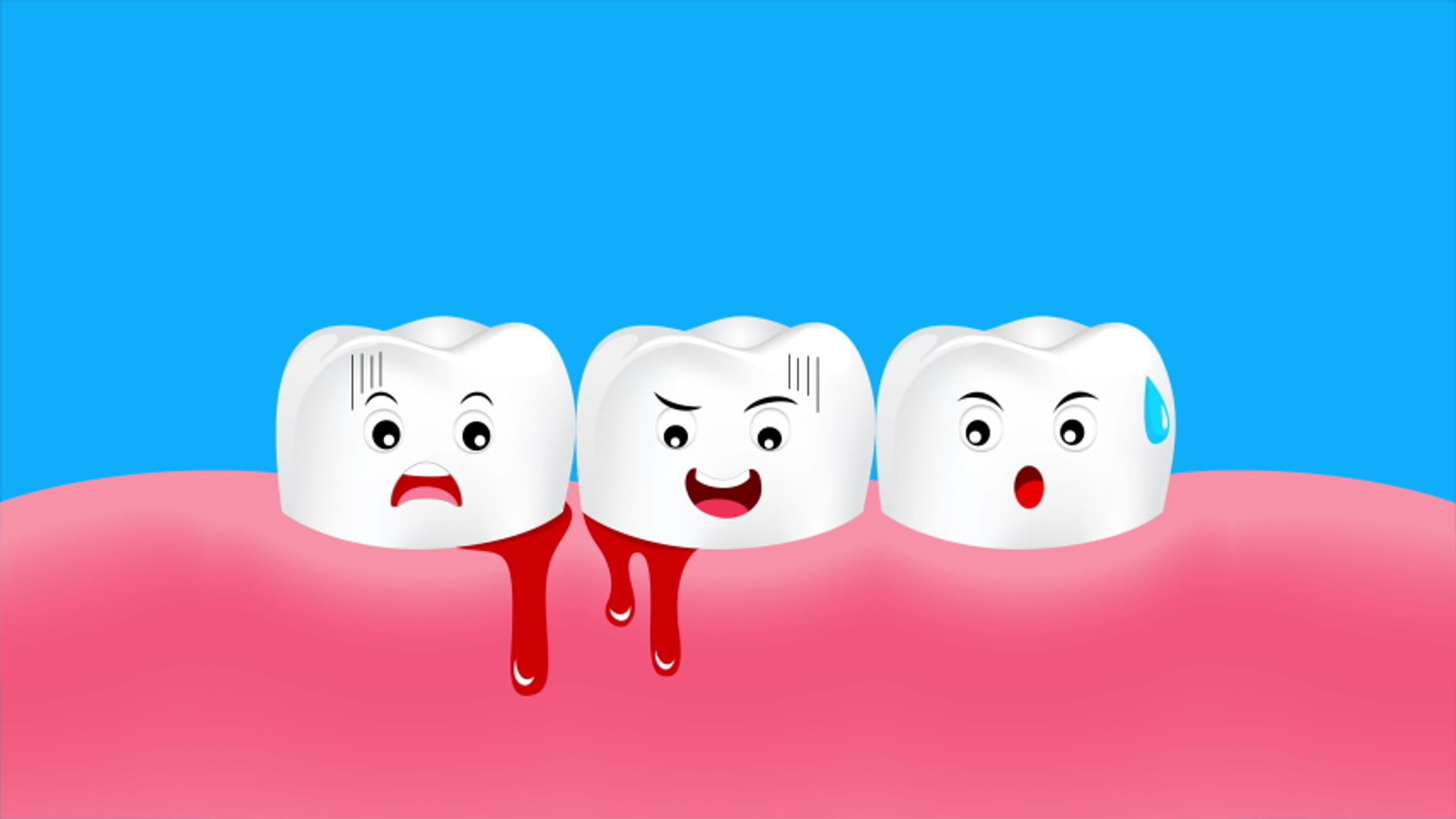Chảy máu chân răng là gì?