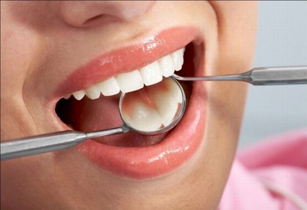 Tổng quan về bệnh răng miệng: Những điều bạn cần biết