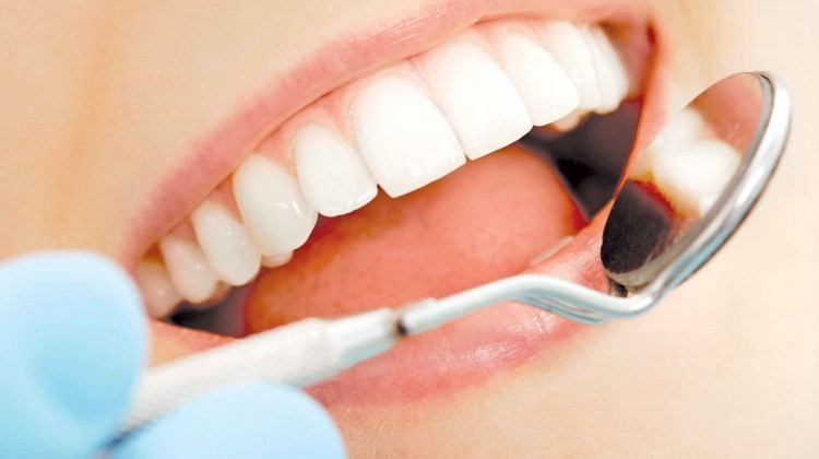 Tình trạng viêm chân răng hàm gặp ở nhiều người