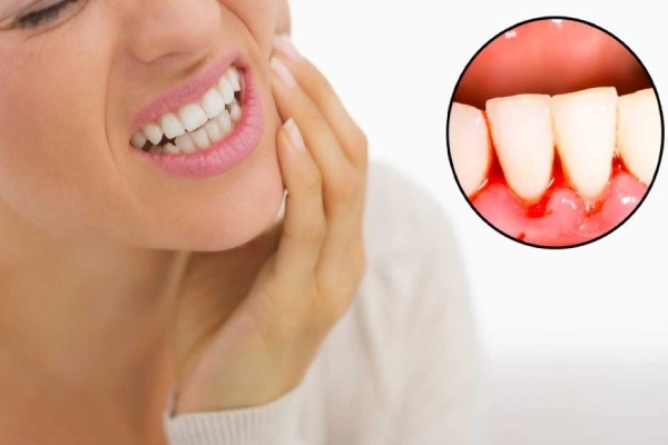 Chảy máu chân răng: Hiểu để điều trị và phòng ngừa