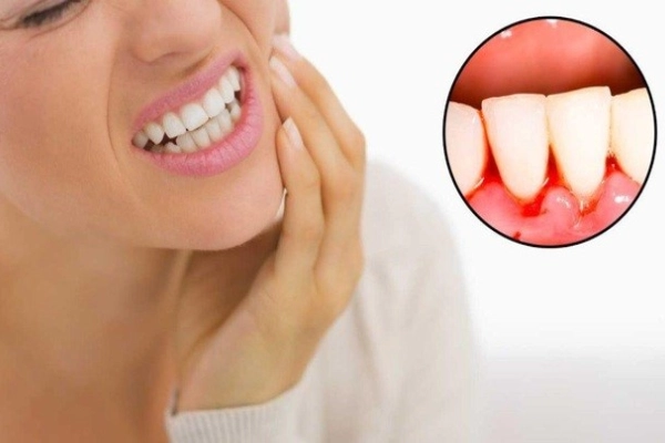 Viêm chân răng khiến người mắc luôn cảm thấy đau nhức