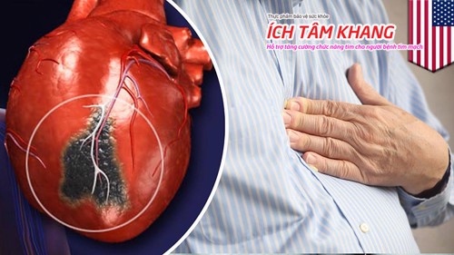 Làm sao để ngăn ngừa thiếu máu cơ tim thầm lặng?