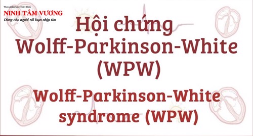 Hiểu về hội chứng wolff-parkinson-white để điều trị hiệu quả